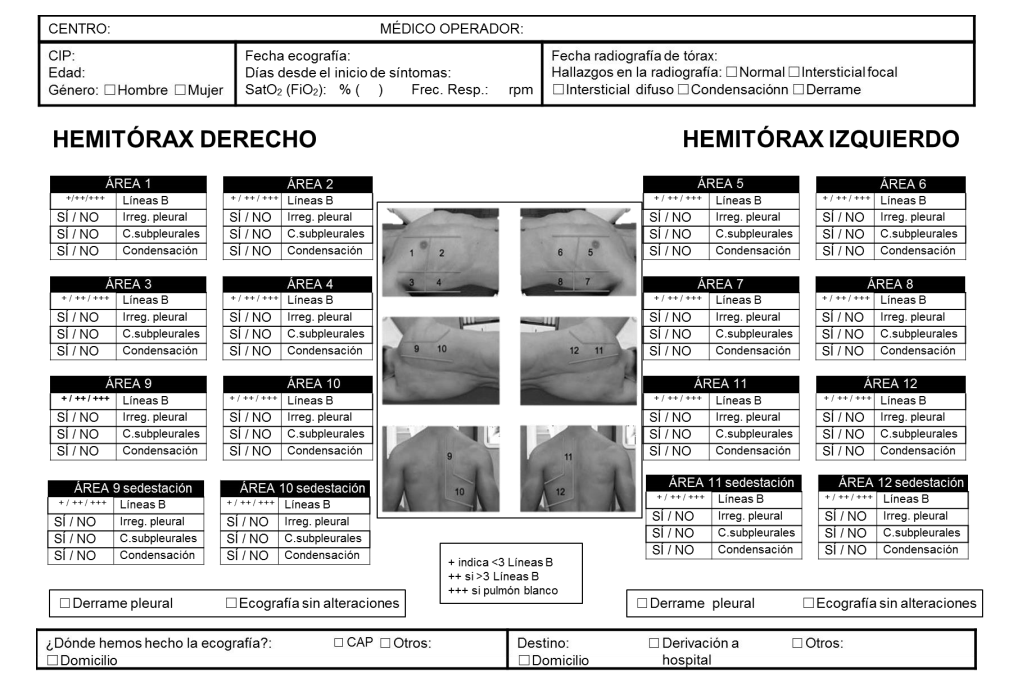 Hoja de recogida de datos