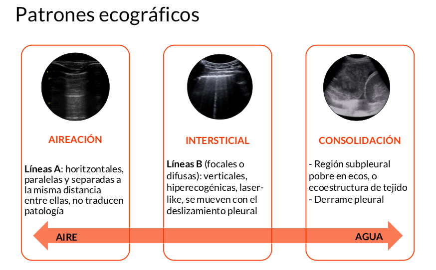 Diferentes estructuras ecográficas